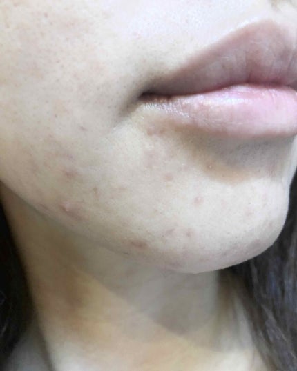 乾燥肌のための美容液洗顔料〈クッション泡〉/SOFINA/洗顔フォームを使ったクチコミ(3枚目)