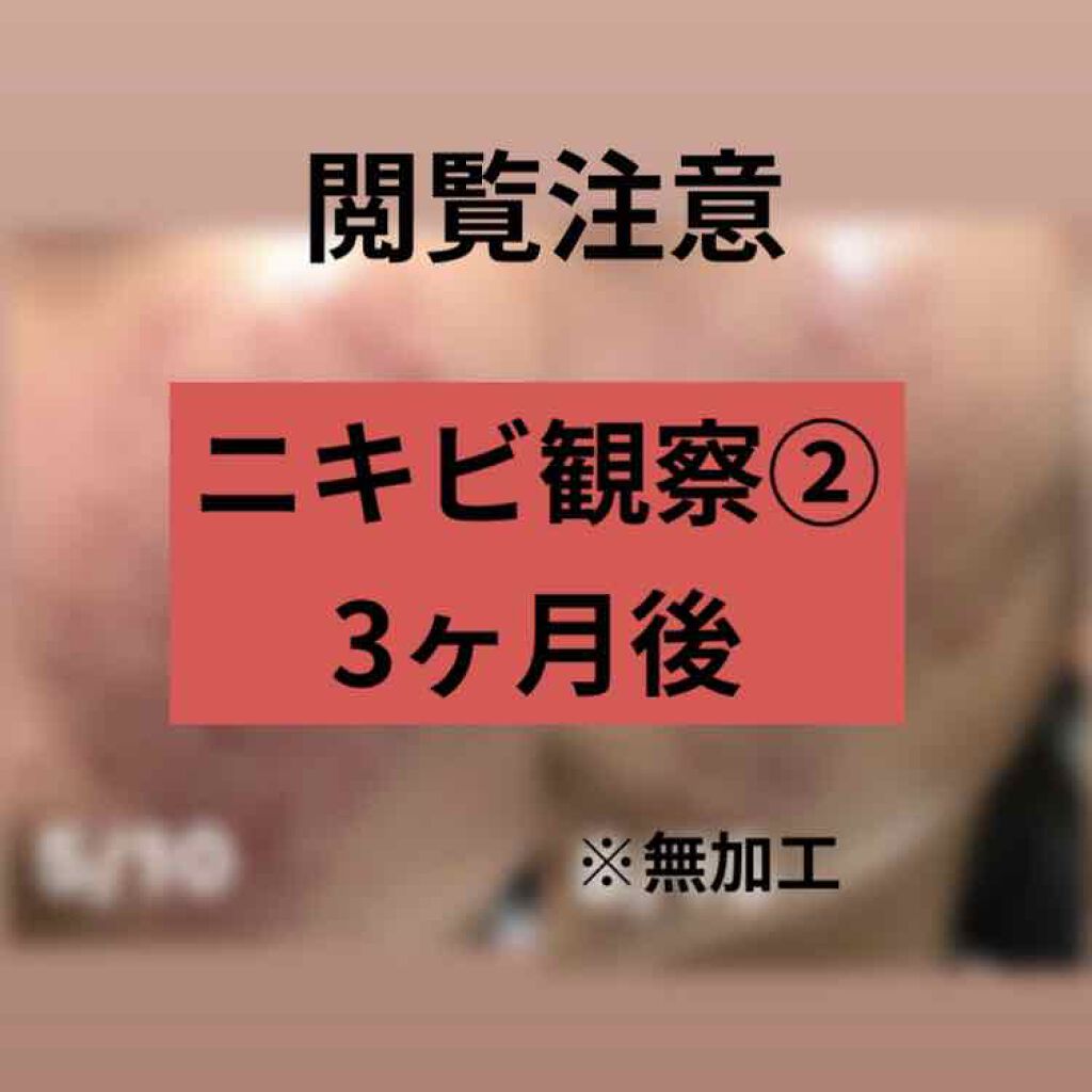 化粧水 しっとりタイプ/ちふれ/化粧水を使ったクチコミ（1枚目）