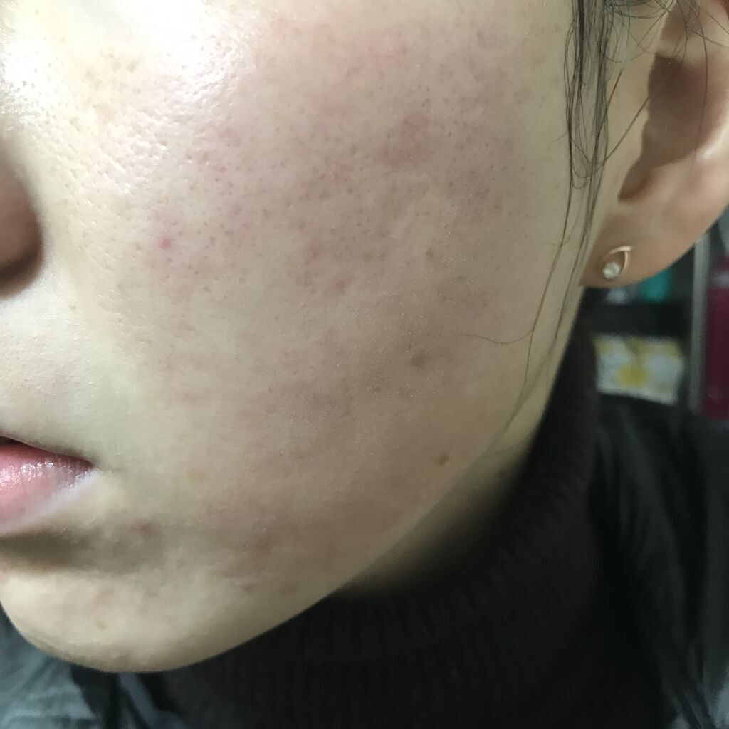 シルコット うるうるコットン/シルコット/コットンを使ったクチコミ（2枚目）