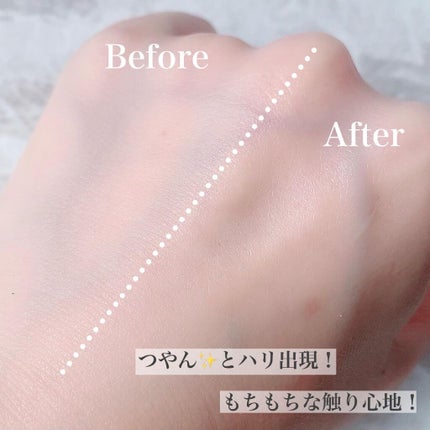 エッセンスTWA/ビーエスコスメ/美容液を使ったクチコミ(4枚目)