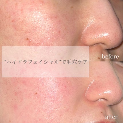 を使ったクチコミ(1枚目)