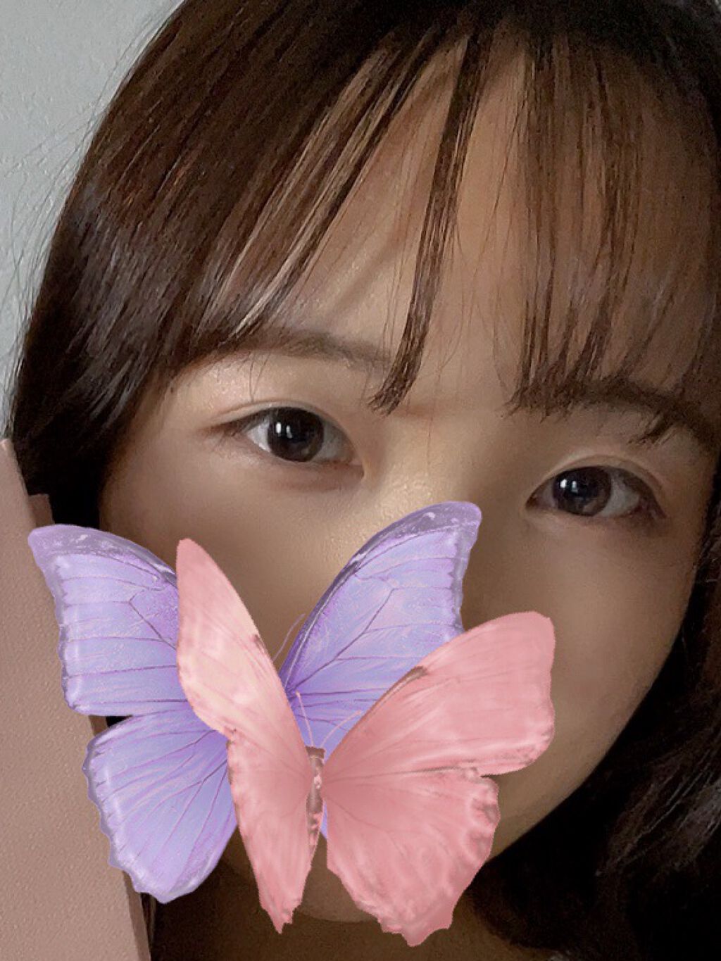 コアラのマーチ on LIPS 「✔️二重埋没の話こんばんは!コアラのマーチと申します!わたしは..」(2枚目)