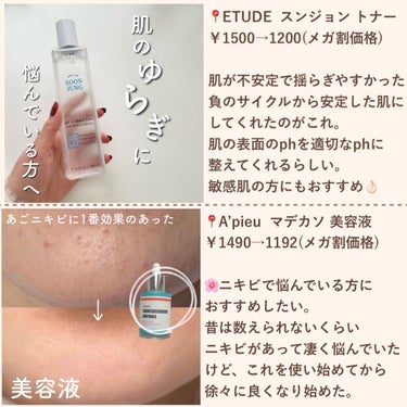 ETUDE モイストフルCL アイケアクリームのクチコミ「＼スキンケアオタクが選ぶ／
Qoo10おすすめスキンケア6選‼️

┈┈┈┈┈┈┈┈┈┈┈┈┈.....」（3枚目）