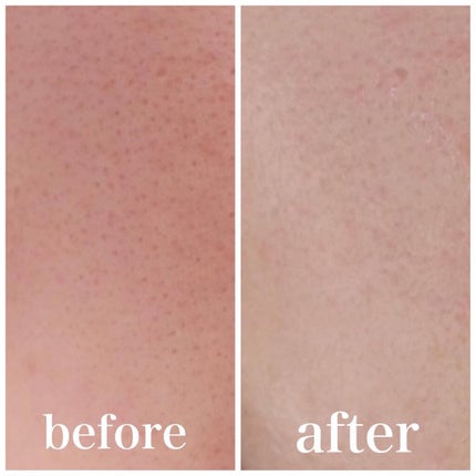 PLUMINUS/mous./美顔器・マッサージを使ったクチコミ(9枚目)