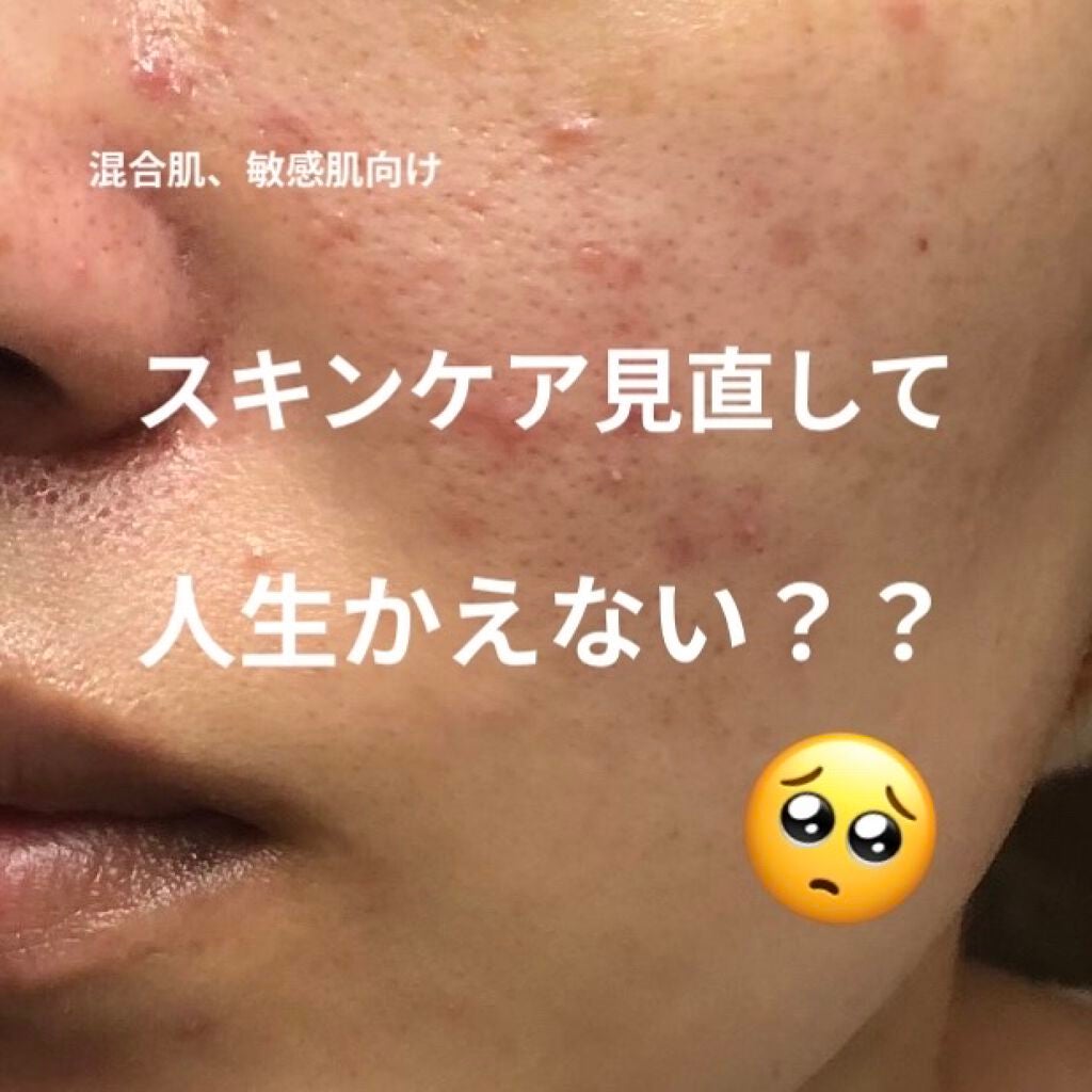 シカスリーピングマスク/LANEIGE/フェイスクリームを使ったクチコミ(1枚目)