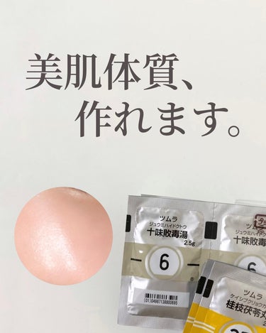 清上防風湯 セイジョウボウフウトウ（医薬品）/ツムラ/その他を使ったクチコミ（1枚目）