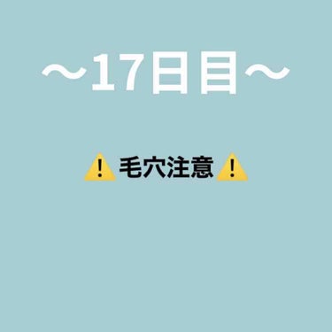 〜初投稿〜

ご覧いただきありがとうございます😄

スキンケアしてかなり時間が経ってるのでテカってます笑

顔もなんか赤いです😢

〜今日したスキンケア〜

・ビフェスタ泡洗顔

こちらは皮膚科に勧めら