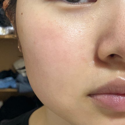 グルカミューンクリーム/VT/フェイスクリームを使ったクチコミ(6枚目)