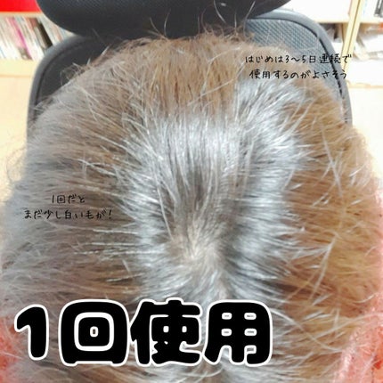 まあちくん★フォロバ100% on LIPS 「#PR#クレイエンス自宅で簡単白髪ケア!【クレイスパカラートリ..」(4枚目)