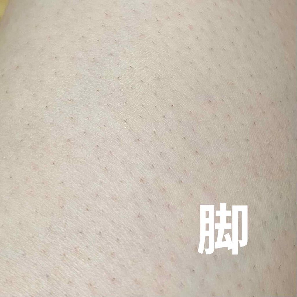 ブラウンシルクエキスパート (光美容器)/ブラウン/家庭用脱毛器を使ったクチコミ(3枚目)