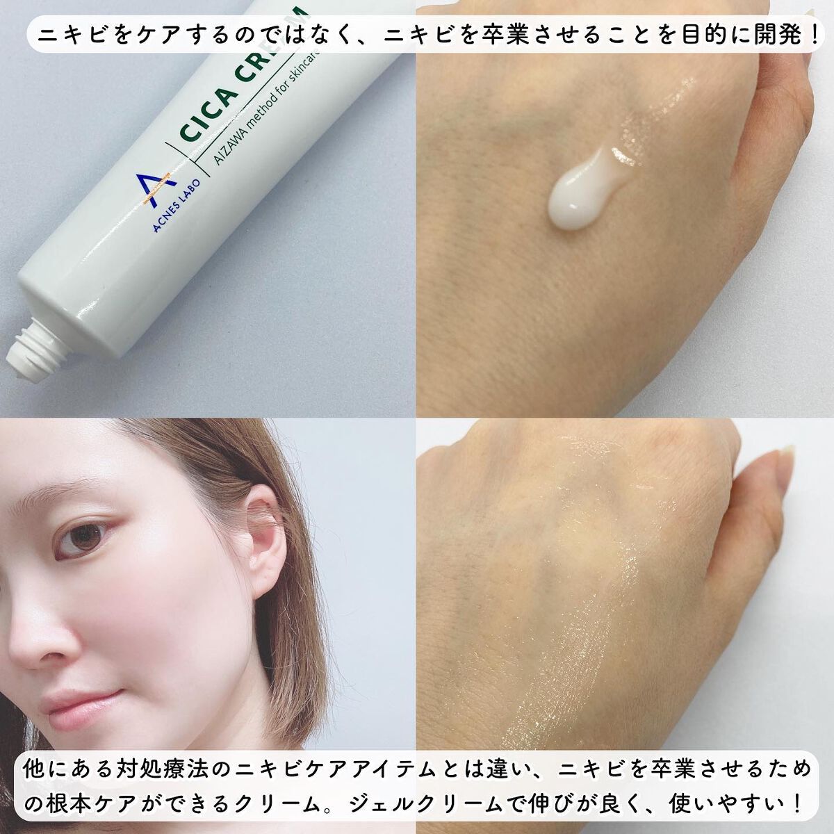 薬用CICAクリーム/アクネスラボ/フェイスクリームを使ったクチコミ（2枚目）
