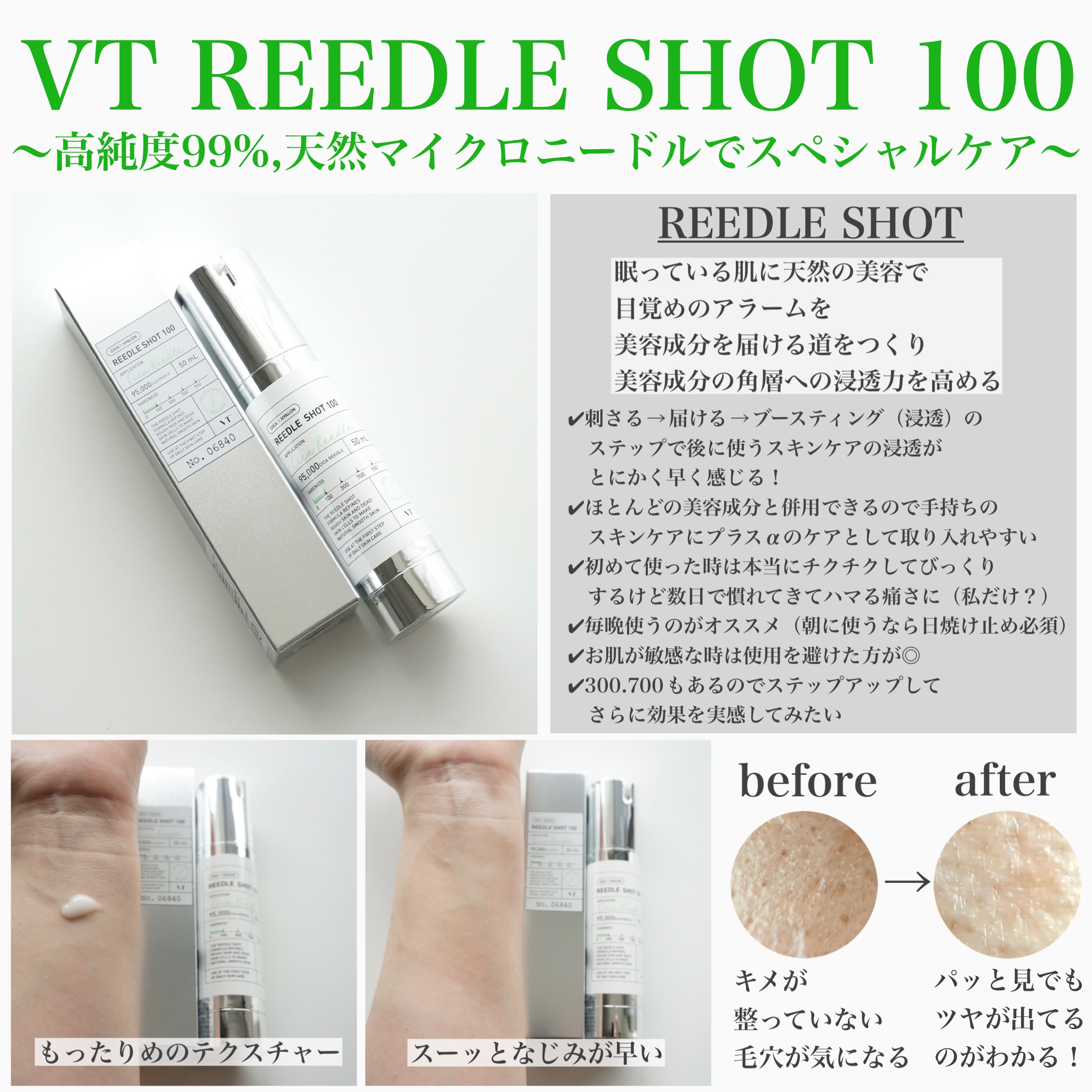 シカバイタル エッセンス/VT/美容液を使ったクチコミ（2枚目）