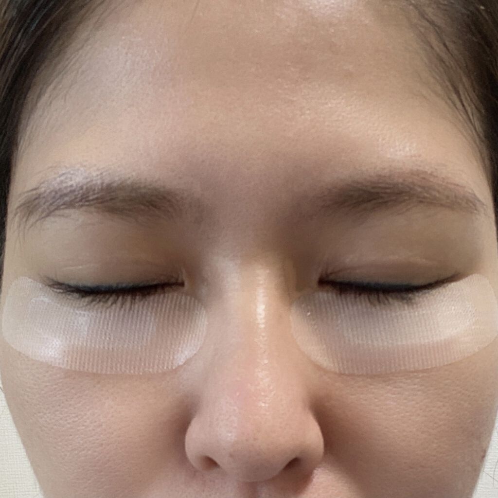 クリアターン ヒアロチューン マイクロパッチ 1500/クリアターン/シートマスク・パックを使ったクチコミ（3枚目）