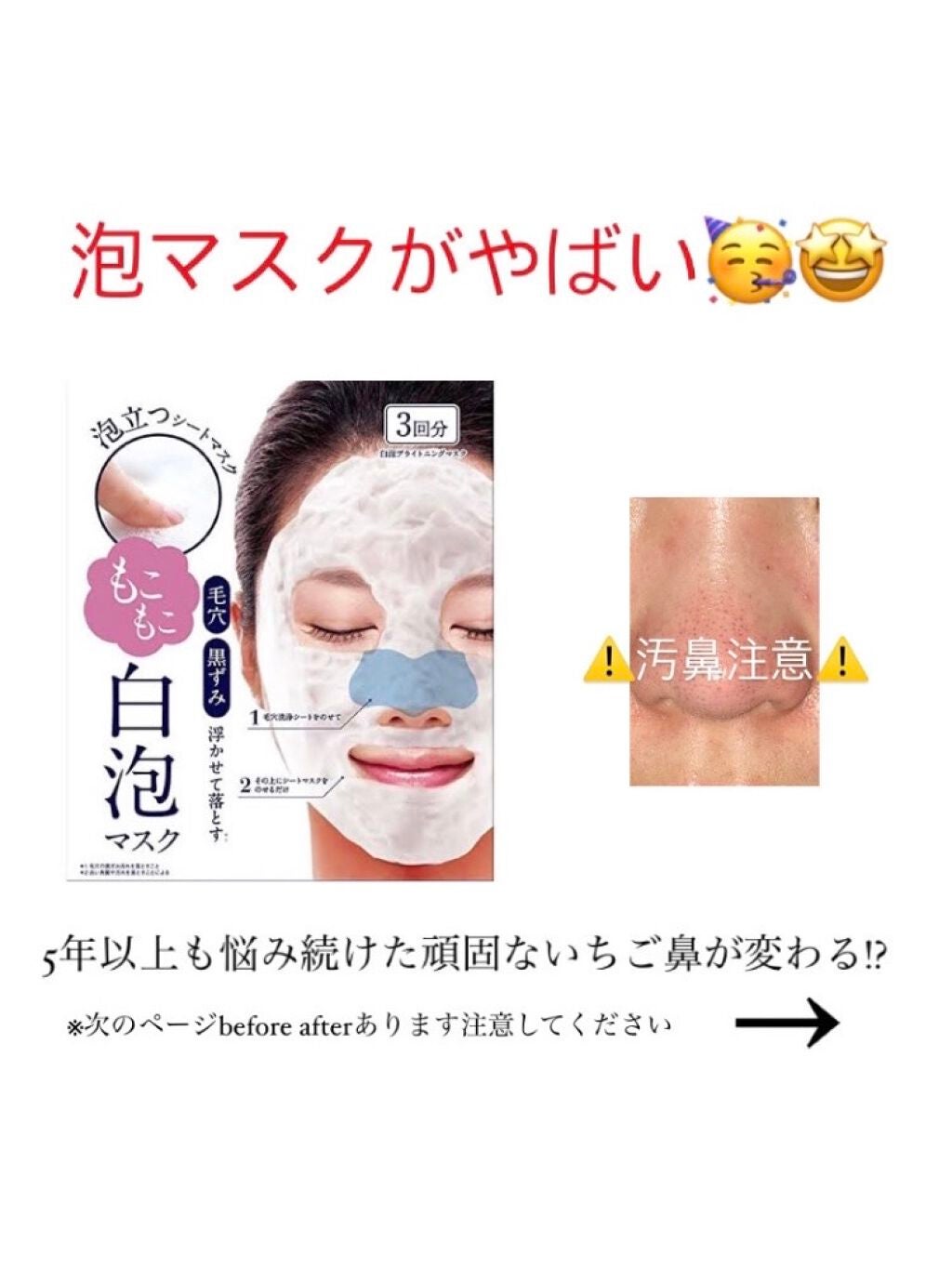 ホワイト もこもこ白泡マスク/リッツ/洗い流すパック・マスクを使ったクチコミ(1枚目)