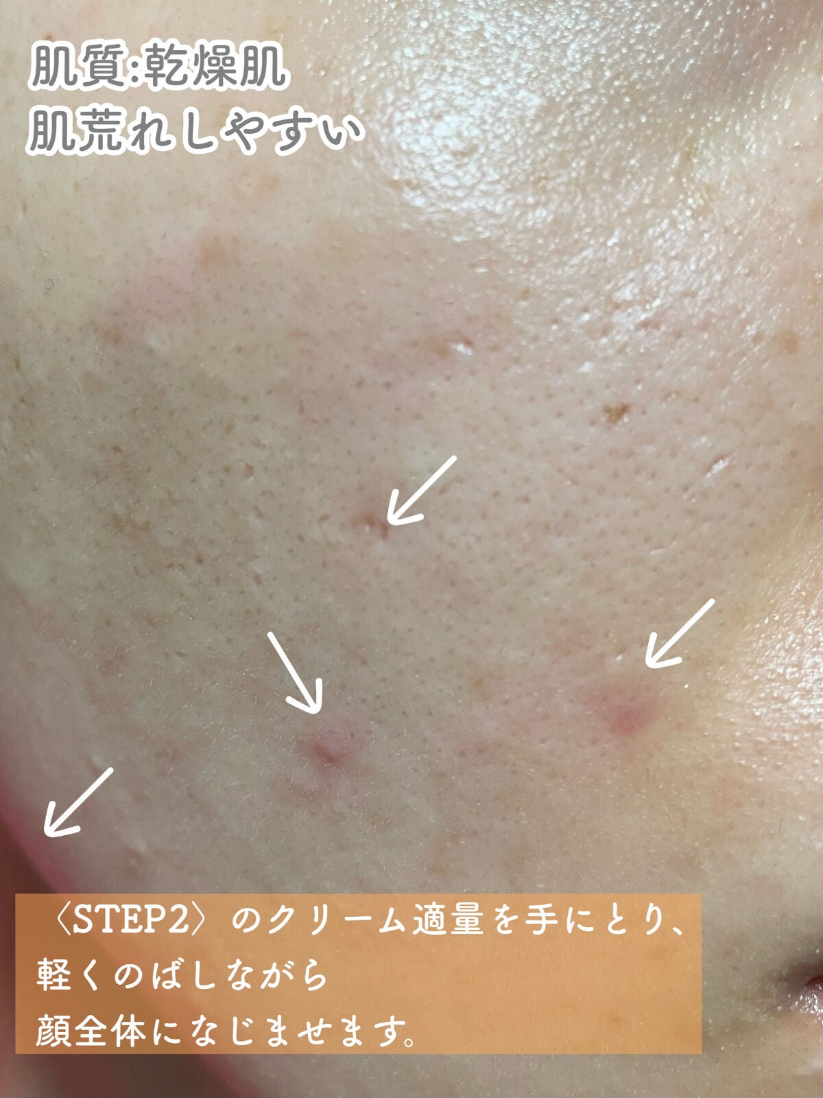 ルミナスマスク (ケアクリーム付き) /cerXcer/シートマスク・パックを使ったクチコミ(5枚目)