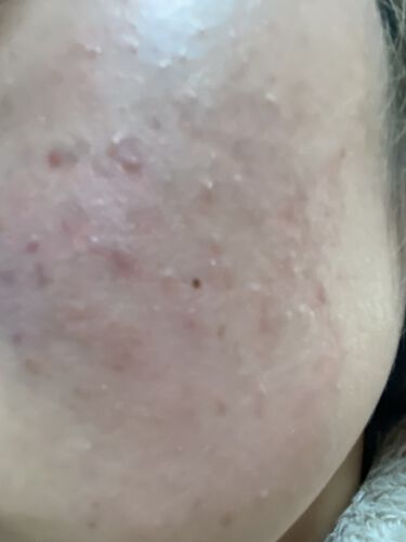 わたしの肌は牛乳石鹸で洗顔しても大丈夫 青箱と赤箱の成分を徹底解説 おすすめの洗顔方法や効果も Lips