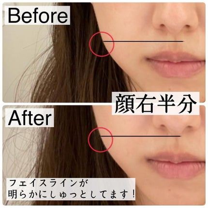 スカルプリフト アクティブ/mysé(ミーゼ)/美顔器・マッサージを使ったクチコミ(5枚目)