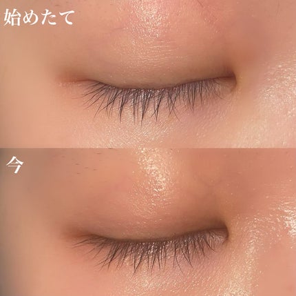 FEG Eyelash Enhancer/FEG/まつげ美容液を使ったクチコミ(2枚目)