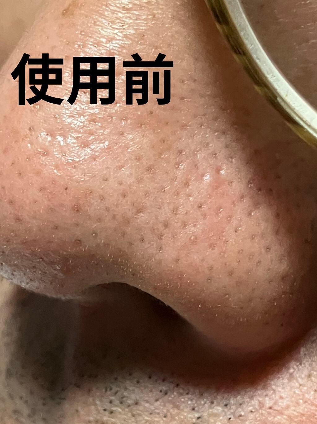 ノーモアブラックヘッド(ノーズピーリング)/One-day's you/スクラブ・ゴマージュを使ったクチコミ(4枚目)