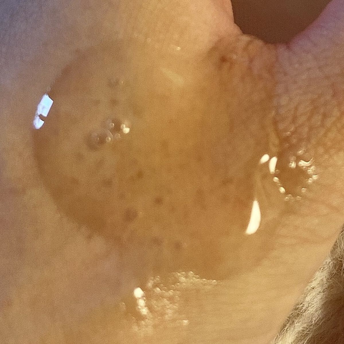 スキンソリューションSOSセラム100ml/FAU/美容液を使ったクチコミ（2枚目）