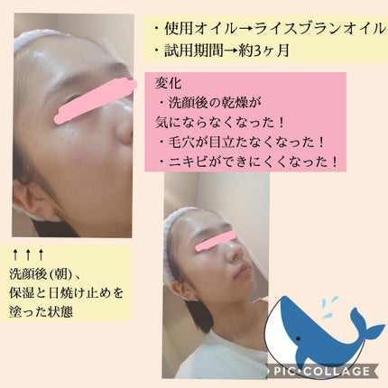 ベビーオイル 無香料/ジョンソンベビー/ボディオイルを使ったクチコミ(3枚目)