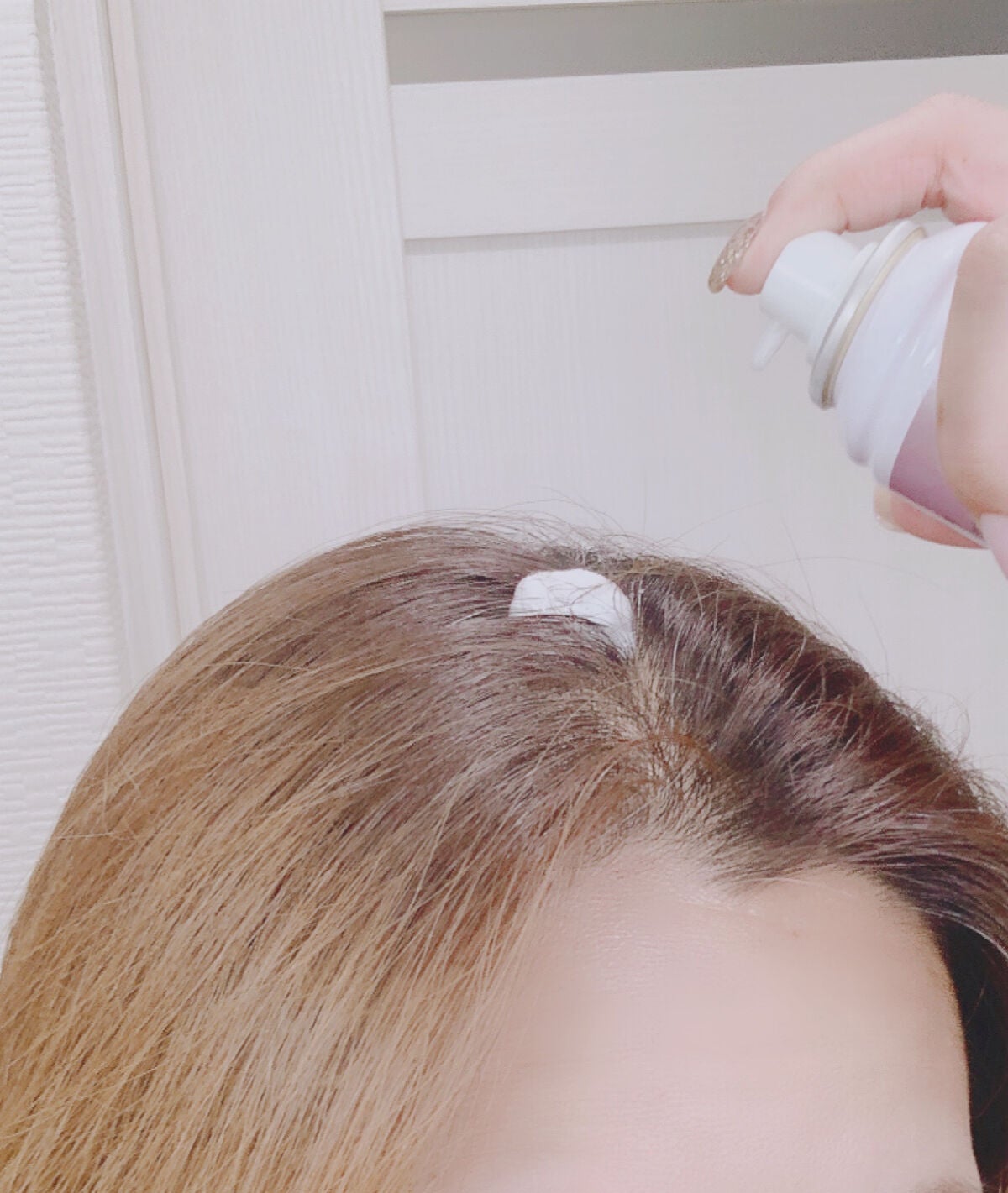 薬用スパークリング スカルプケア/ドクターベルツ/頭皮ローションを使ったクチコミ(3枚目)