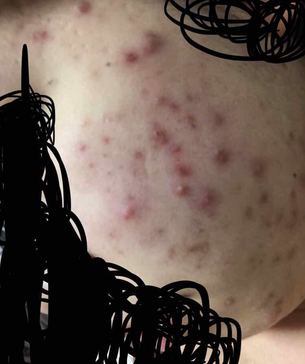 ハトムギ化粧水(ナチュリエ スキンコンディショナー R )/ナチュリエ/化粧水を使ったクチコミ（2枚目）