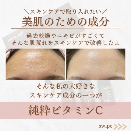 ディープビタCアンプル2.0/MEDICUBE/美容液を使ったクチコミ(2枚目)