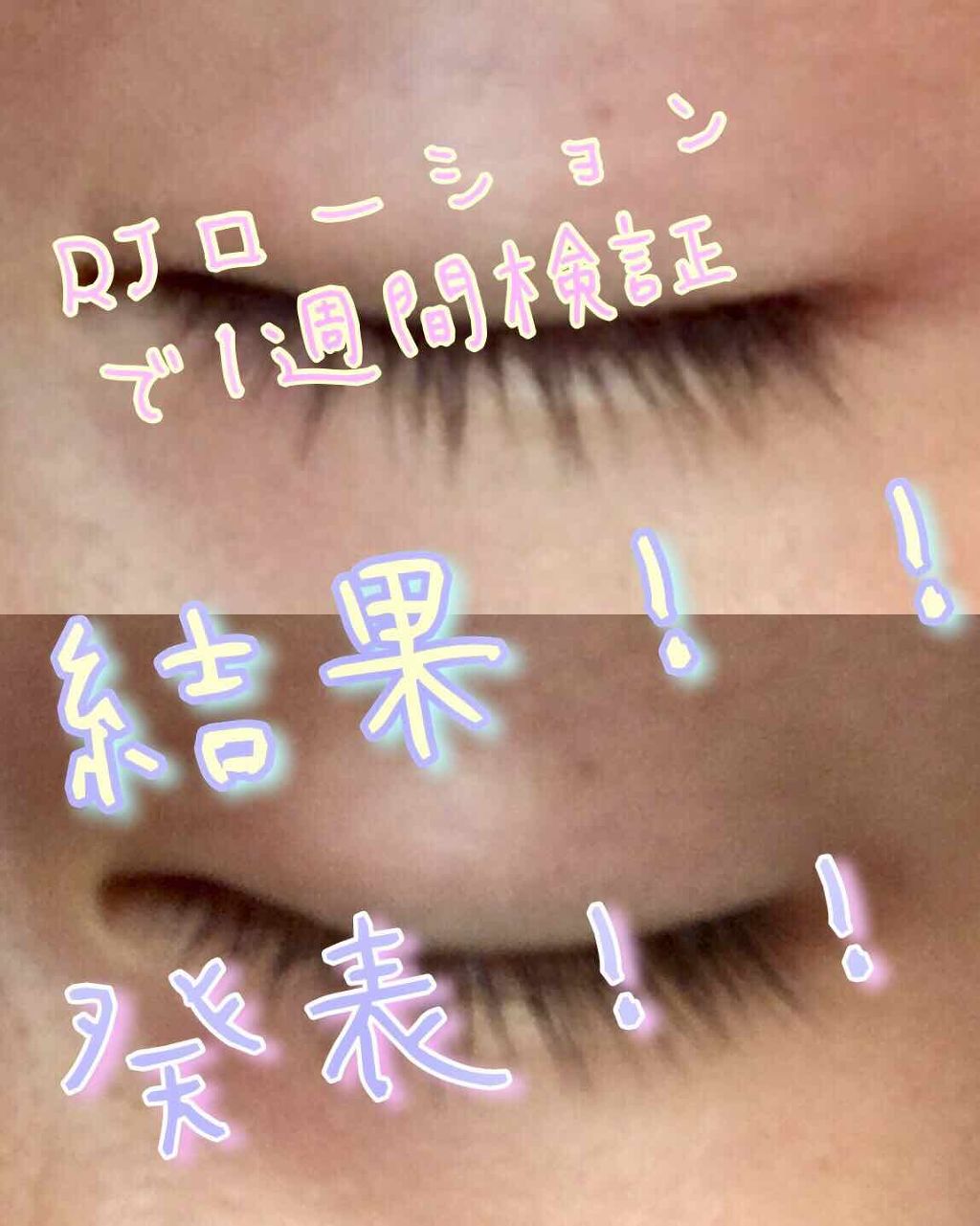 ローヤルゼリー配合 栄養ローション/DAISO/美容液を使ったクチコミ（1枚目）