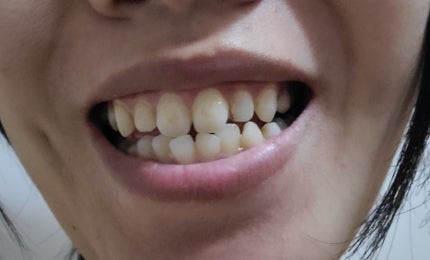 ブレスマイルクリア/BRESMILE(ブレスマイル)/歯磨き粉を使ったクチコミ(2枚目)