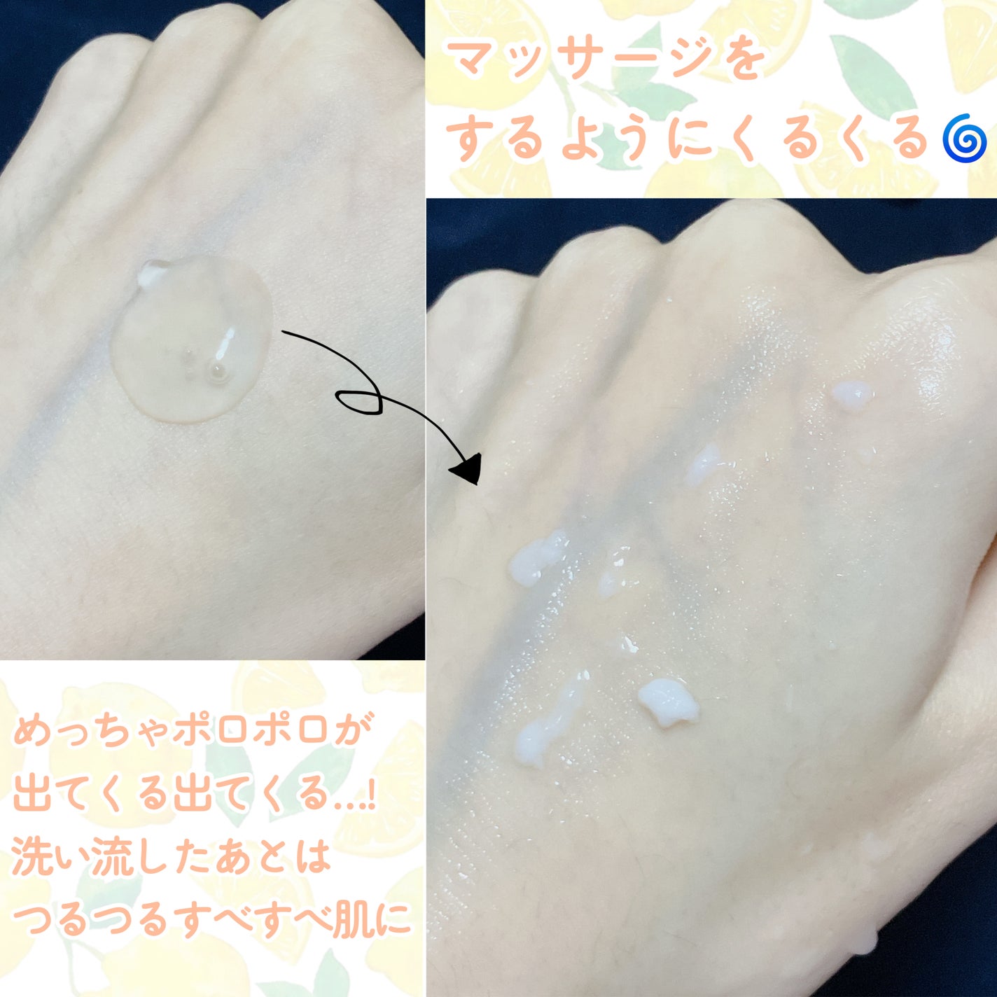 DETクリア ブライト&ピール ピーリングジェリー<ミックスフルーツの香り>/Detclear/ピーリングを使ったクチコミ(3枚目)