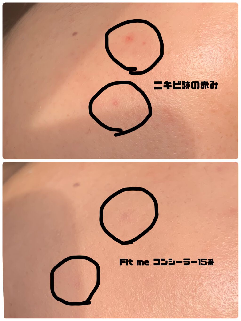 フィットミー コンシーラー/MAYBELLINE NEW YORK/リキッドコンシーラーを使ったクチコミ（2枚目）