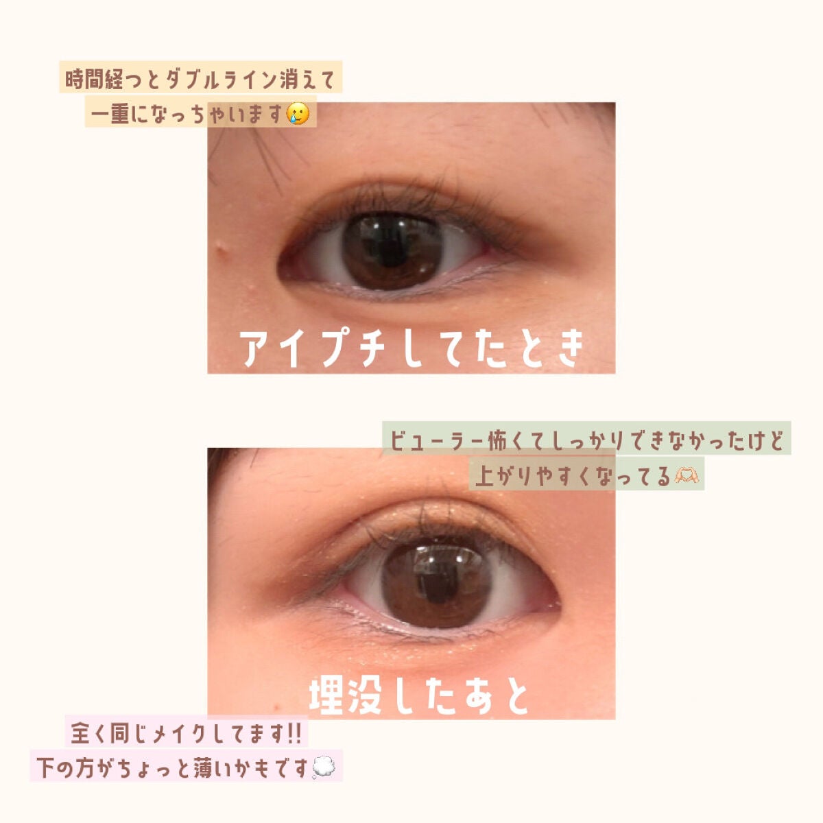 アイビューティー フィクサー WP/アストレア ヴィルゴ/二重まぶた用アイテムを使ったクチコミ(3枚目)