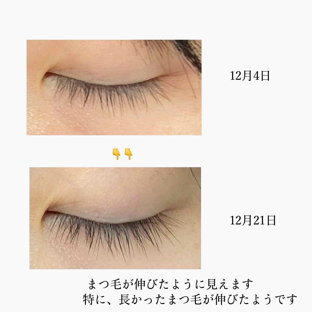 スカルプD ボーテ ピュアフリーアイラッシュセラム プレミアム