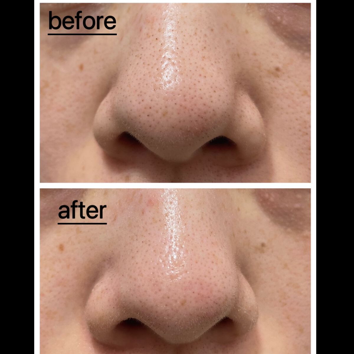 カロテンIPMP(TM) とろけるクレンジングバーム /APRILSKIN/クレンジングバームを使ったクチコミ(4枚目)