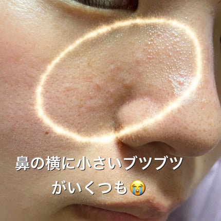 ウォーターピーリング超音波美顔器/ANLAN/美顔器・マッサージを使ったクチコミ(2枚目)