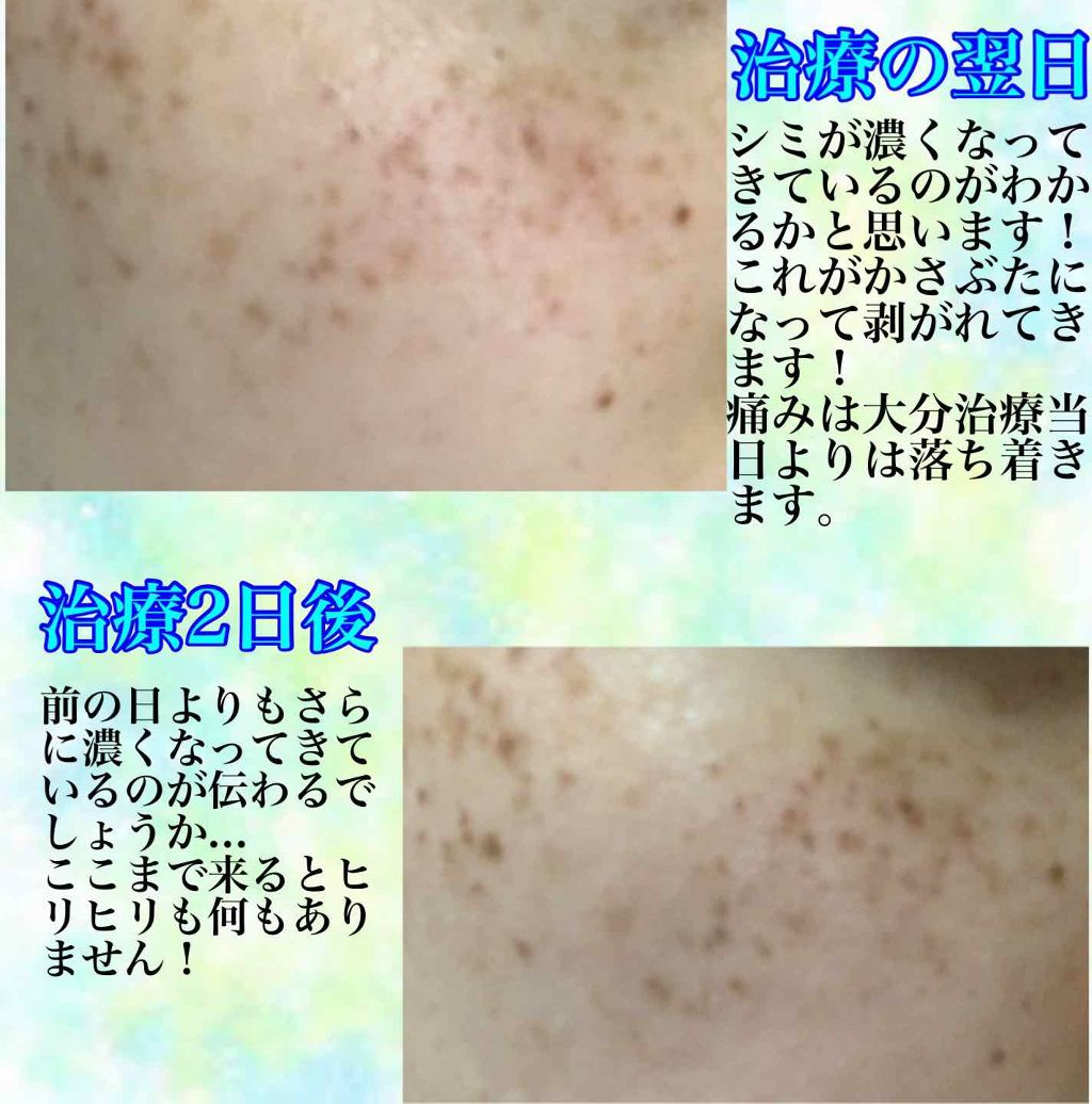 を使ったクチコミ（3枚目）