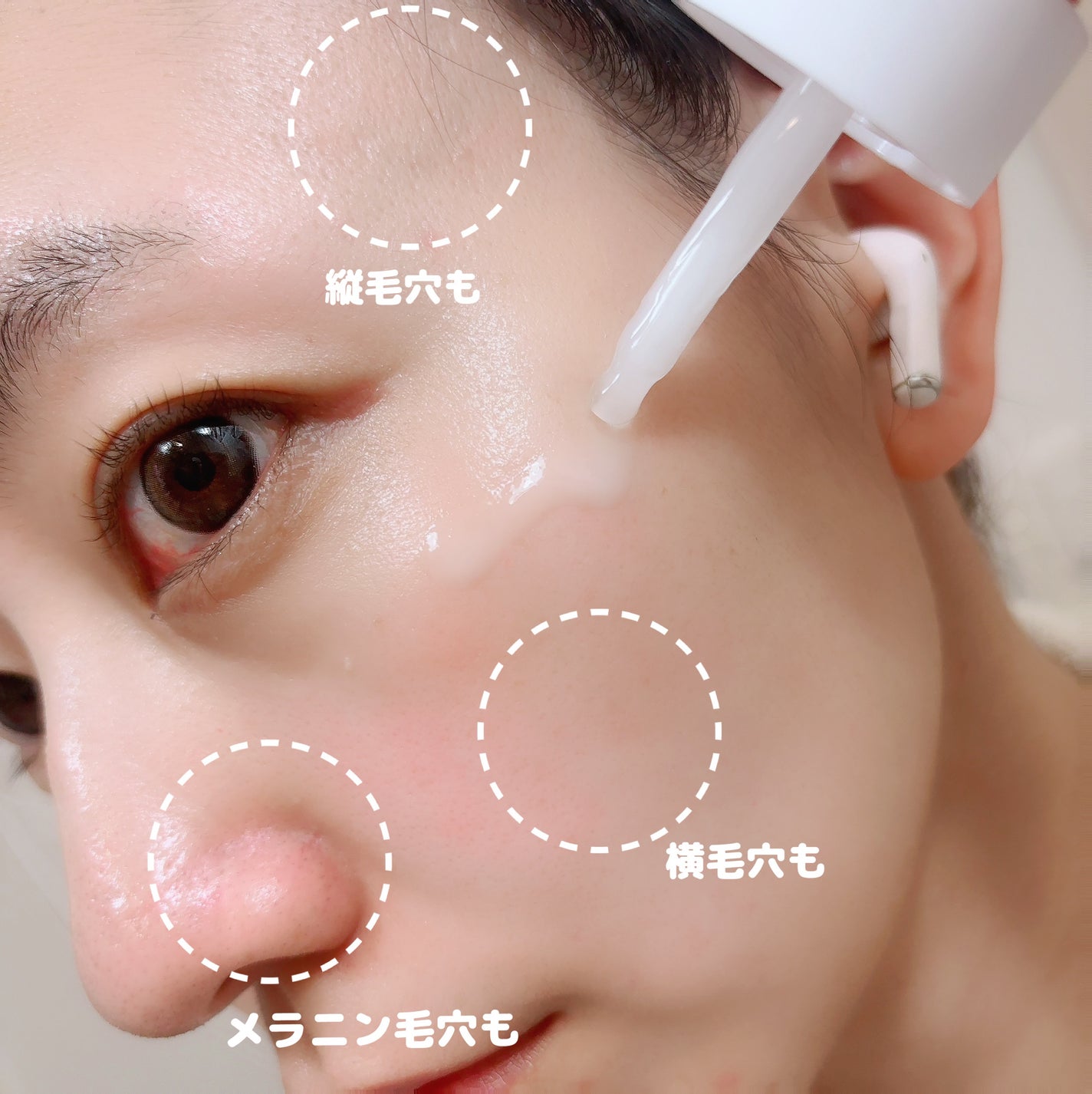 毛穴アンプル/ブラン/美容液を使ったクチコミ(3枚目)