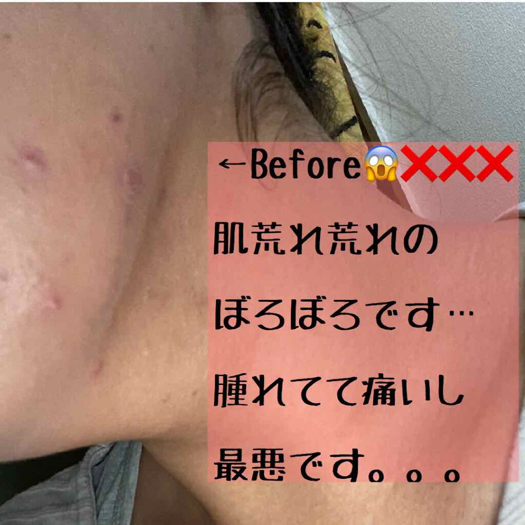 MAAs リペアエッセンス/Dr. Choi's Solution/美容液を使ったクチコミ(2枚目)