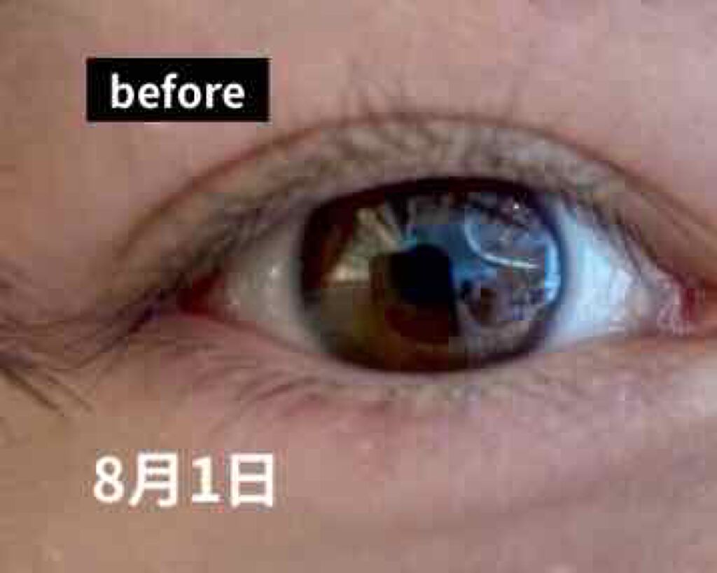 スカルプD ボーテ ピュアフリーアイラッシュセラム/アンファー(スカルプD)/まつげ美容液を使ったクチコミ(1枚目)