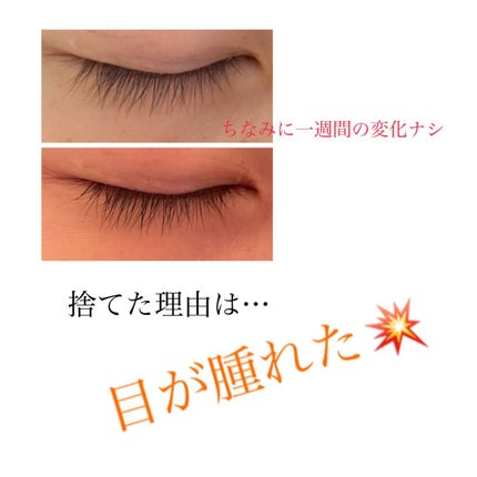 FEG  Eyelash  Enhancer/FEG/まつげ美容液を使ったクチコミ(2枚目)