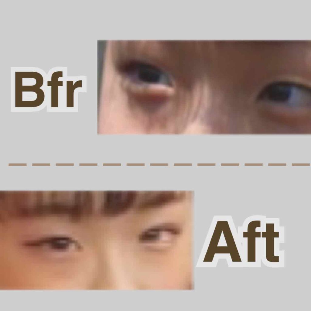 ふたえナイトパック リッチ＆ハード/ベクトラス/二重まぶた用アイテムを使ったクチコミ（2枚目）