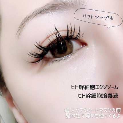 marc♡美容垢フォロバ on LIPS 「♡綺麗でいたい人必見✨1㎖あたり500億個のヒト幹細胞エクソソ..」(6枚目)