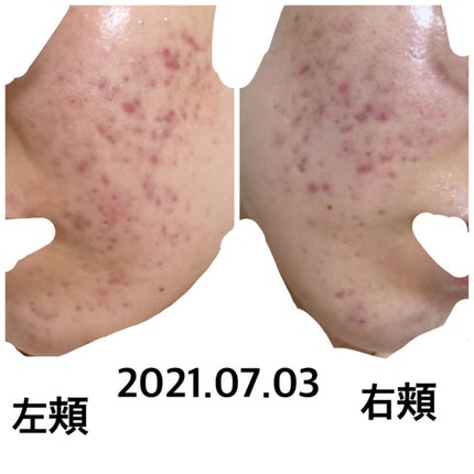 を使ったクチコミ(1枚目)