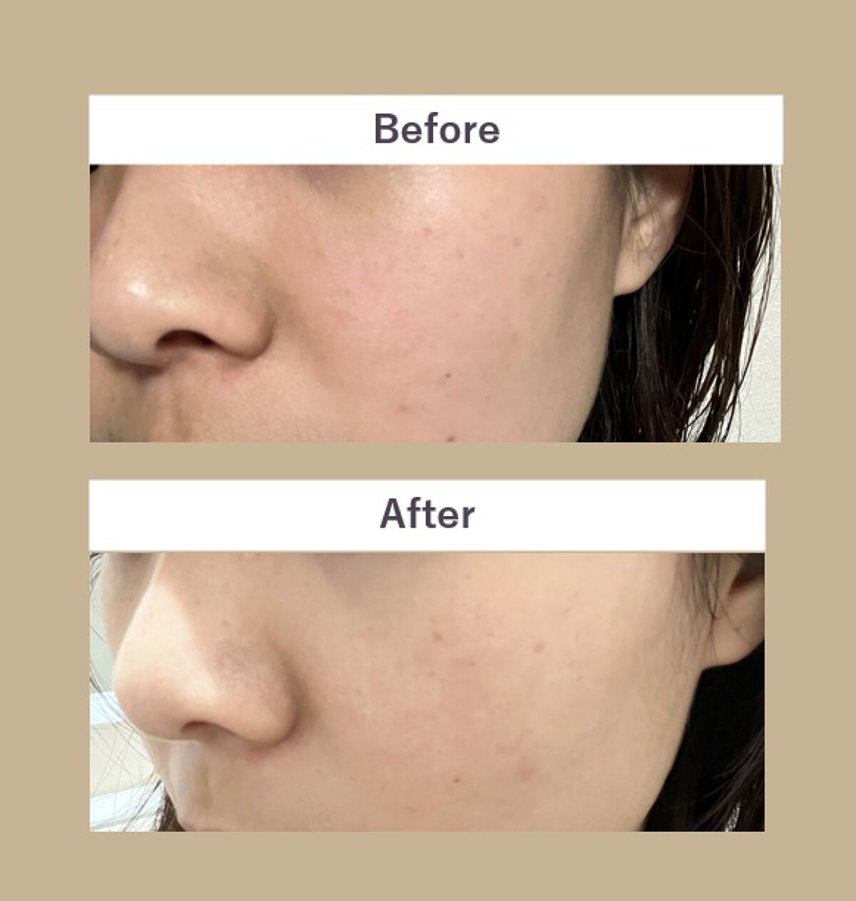 Shin HIFU-Line foam doux cleanser /BPCXTRA/その他洗顔料を使ったクチコミ（2枚目）