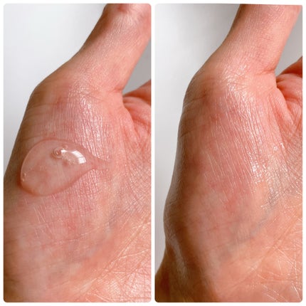 グルカミューンエッセンス /VT/美容液を使ったクチコミ(2枚目)