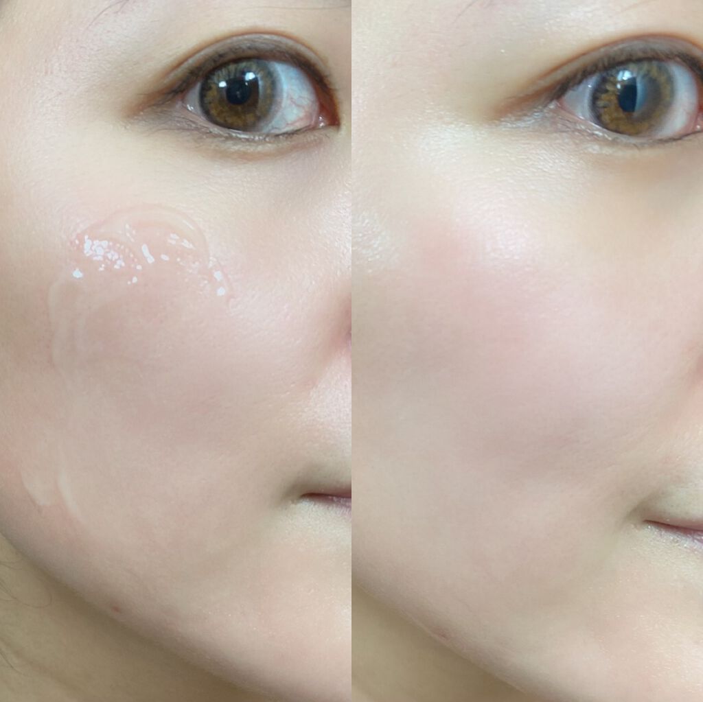 モイストゲルプラス/Re dermalab/オールインワン化粧品を使ったクチコミ(2枚目)