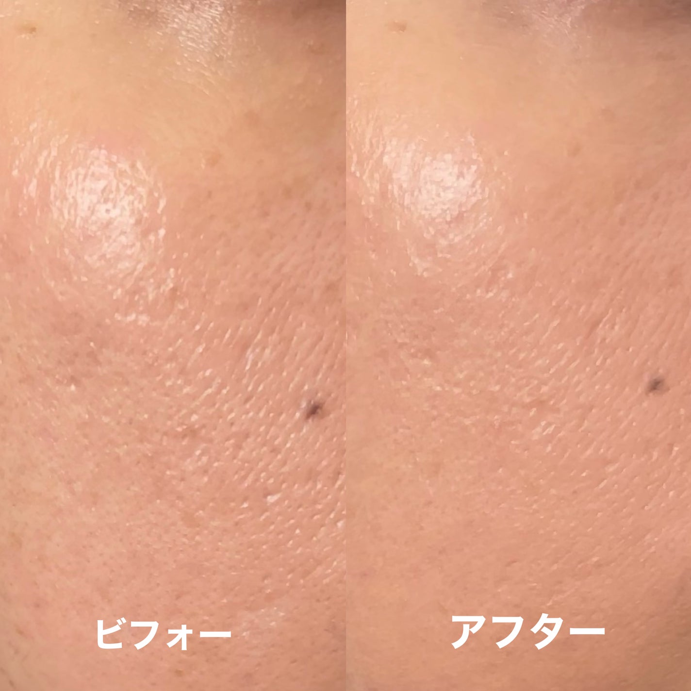 薬用クリアエステヴェールEX/Macchia Label/リキッドファンデーションを使ったクチコミ(5枚目)