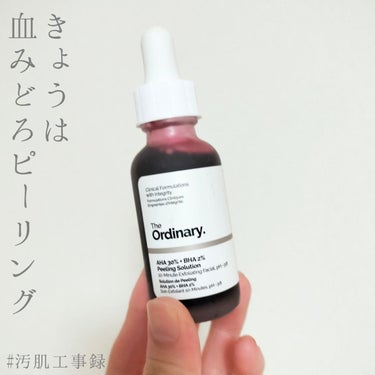 ワセリンHG チューブ (化粧用油)/大洋製薬/ボディクリームを使ったクチコミ（1枚目）