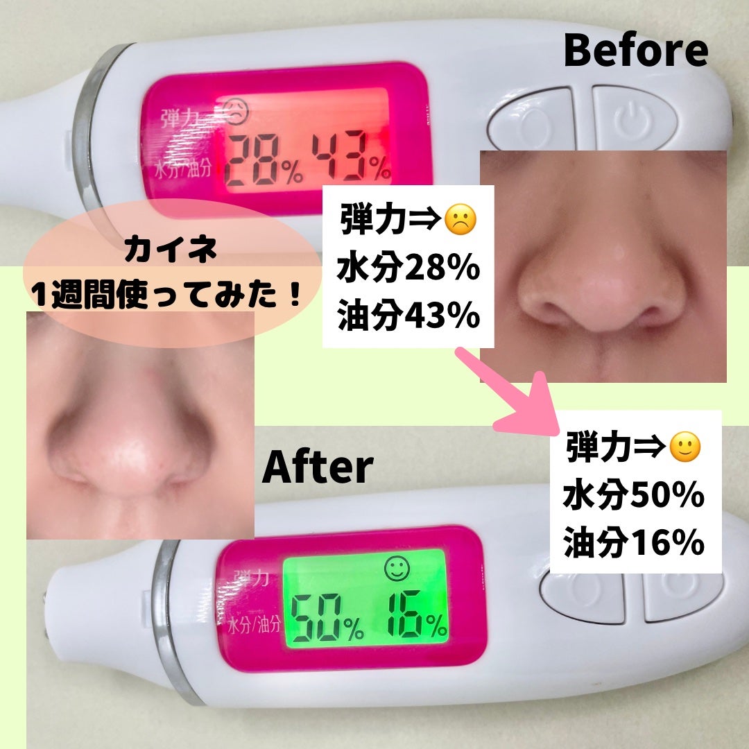 コンブバランスアンプルトナー/KAINE/化粧水を使ったクチコミ(5枚目)